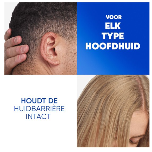 Head & Shoulders Citrus Fresh - Anti-Roos Shampoo - Voor Vet Haar - Dagelijks Gebruik - Voordeelverpakking 6 x 400 ml