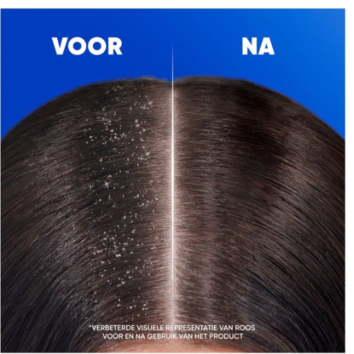 Head & Shoulders Menthol Fresh - Anti-Roos Shampoo - Dagelijks Gebruik - Fris Gevoel - Voordeelverpakking 6 x 400 ml