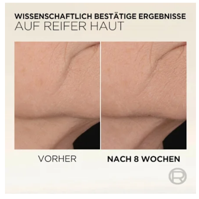 L'Oréal Paris Age Perfect Verstevigend, direct versterkend Serum - 30ml